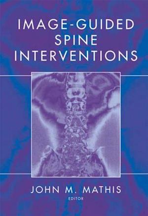 Image-Guided Spine Interventions