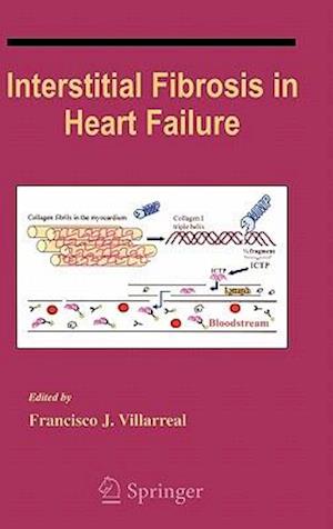 Interstitial Fibrosis in Heart Failure