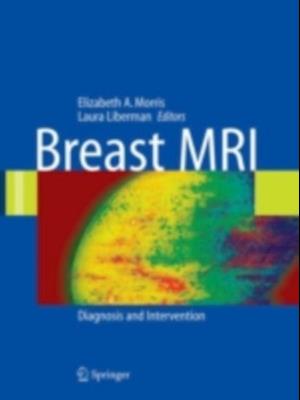 Breast MRI