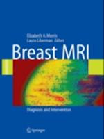 Breast MRI