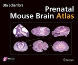 Prenatal Mouse Brain Atlas