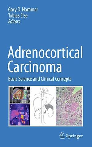 Adrenocortical Carcinoma