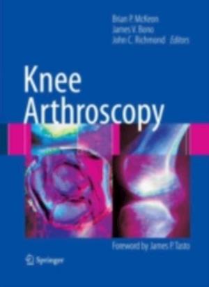 Knee Arthroscopy