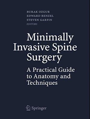 Minimally Invasive Spine Surgery