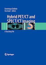 Hybrid PET/CT and SPECT/CT Imaging