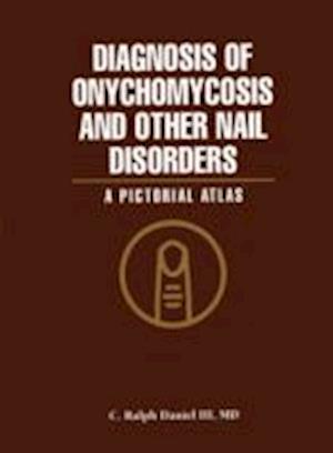 Diagnosis of Onychomycosis and Other Nail Disorders