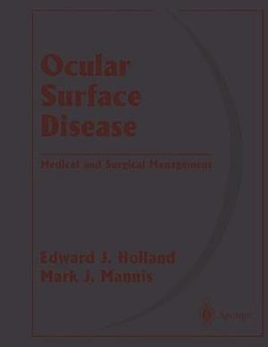 Ocular Surface Disease