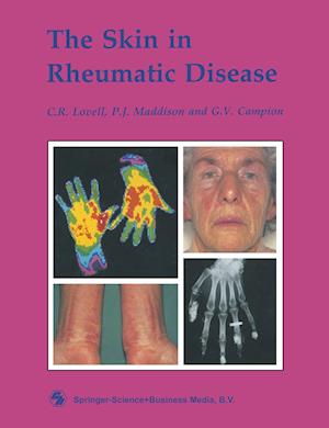 The Skin in Rheumatic Disease