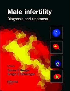 Male Infertility