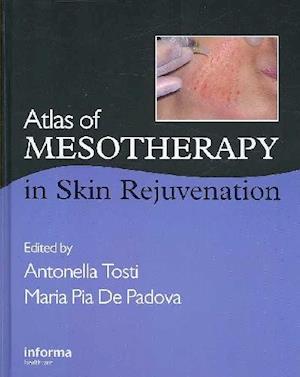 Atlas of Mesotherapy in Skin Rejuvenation