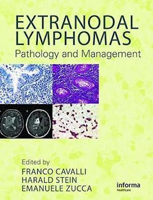 Extranodal Lymphomas