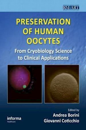 Preservation of Human Oocytes