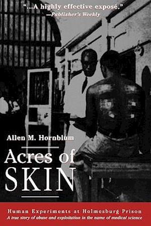 Acres of Skin