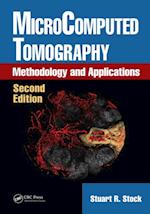 MicroComputed Tomography