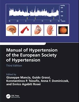 Manual of Hypertension of the European Society of Hypertension, Third Edition