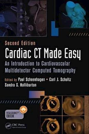 Cardiac CT Made Easy