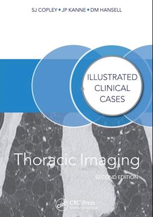 Thoracic Imaging