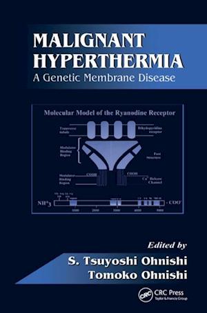 Malignant Hyperthermia