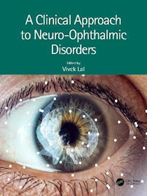 Clinical Approach to Neuro-Ophthalmic Disorders