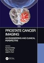 Prostate Cancer Imaging