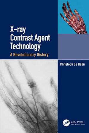 X-ray Contrast Agent Technology