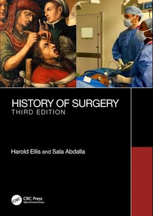 History of Surgery