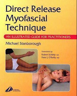 Direct Release Myofascial Technique