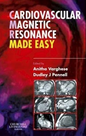 Cardiovascular Magnetic Resonance Made Easy