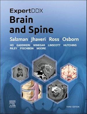 ExpertDDx: Brain and Spine E-Book