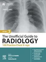 Unofficial Guide to Radiology: 100 Practice Chest X-rays - E-Book