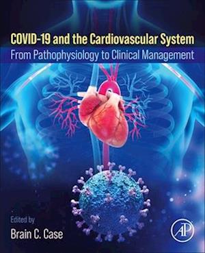 COVID-19 and the Cardiovascular System