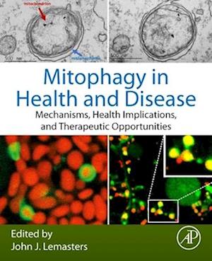 Mitophagy in Health and Disease