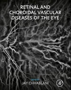 Retinal and Choroidal Vascular Diseases of the Eye