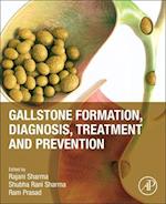 Gallstone Formation, Diagnosis, Treatment and Prevention