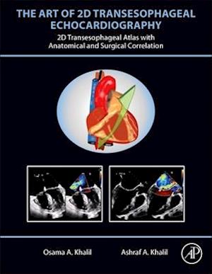 Art of 2D Transesophageal Echocardiography