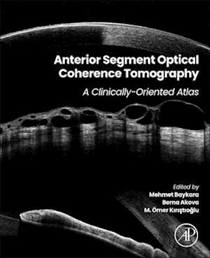 Anterior Segment Optical Coherence Tomography