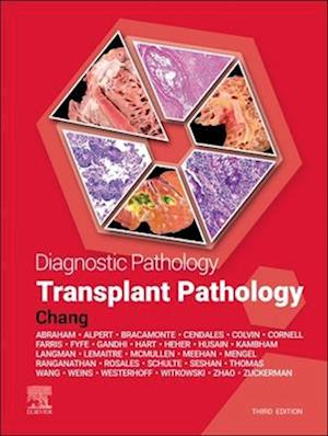 Diagnostic Pathology: Transplant Pathology - E-BOOK