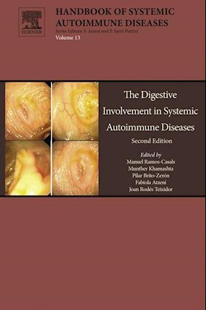 Digestive Involvement in Systemic Autoimmune Diseases