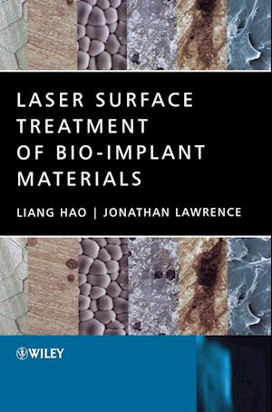 Laser Surface Treatment of Bio–Implant Materials