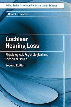 Cochlear Hearing Loss