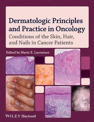 Dermatologic Principles and Practice in Oncology