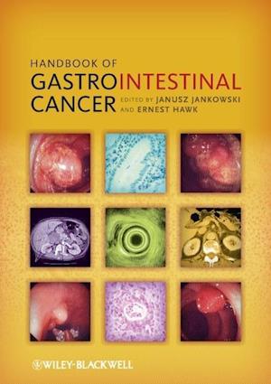 Handbook of Gastrointestinal Cancer