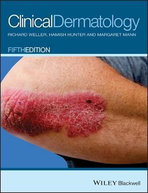 Clinical Dermatology 5e