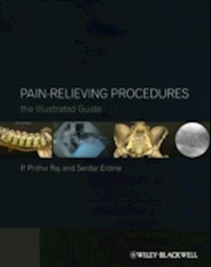 Pain-Relieving Procedures