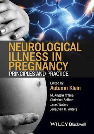 Neurological Illness in Pregnancy – Principles and Practice
