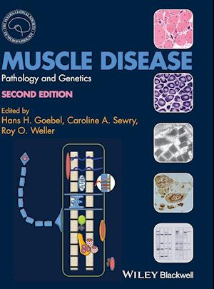 Muscle Disease