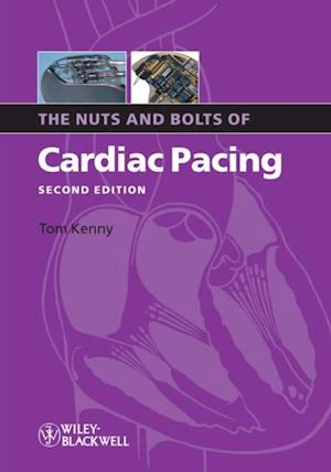 Nuts and Bolts of Cardiac Pacing