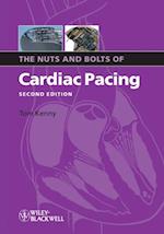 Nuts and Bolts of Cardiac Pacing