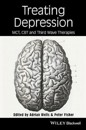 Treating Depression – MCT, CBT and Third Wave pies