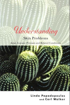 Understanding Skin Problems – Acne, Eczema, Psoriasis and Related Conditions